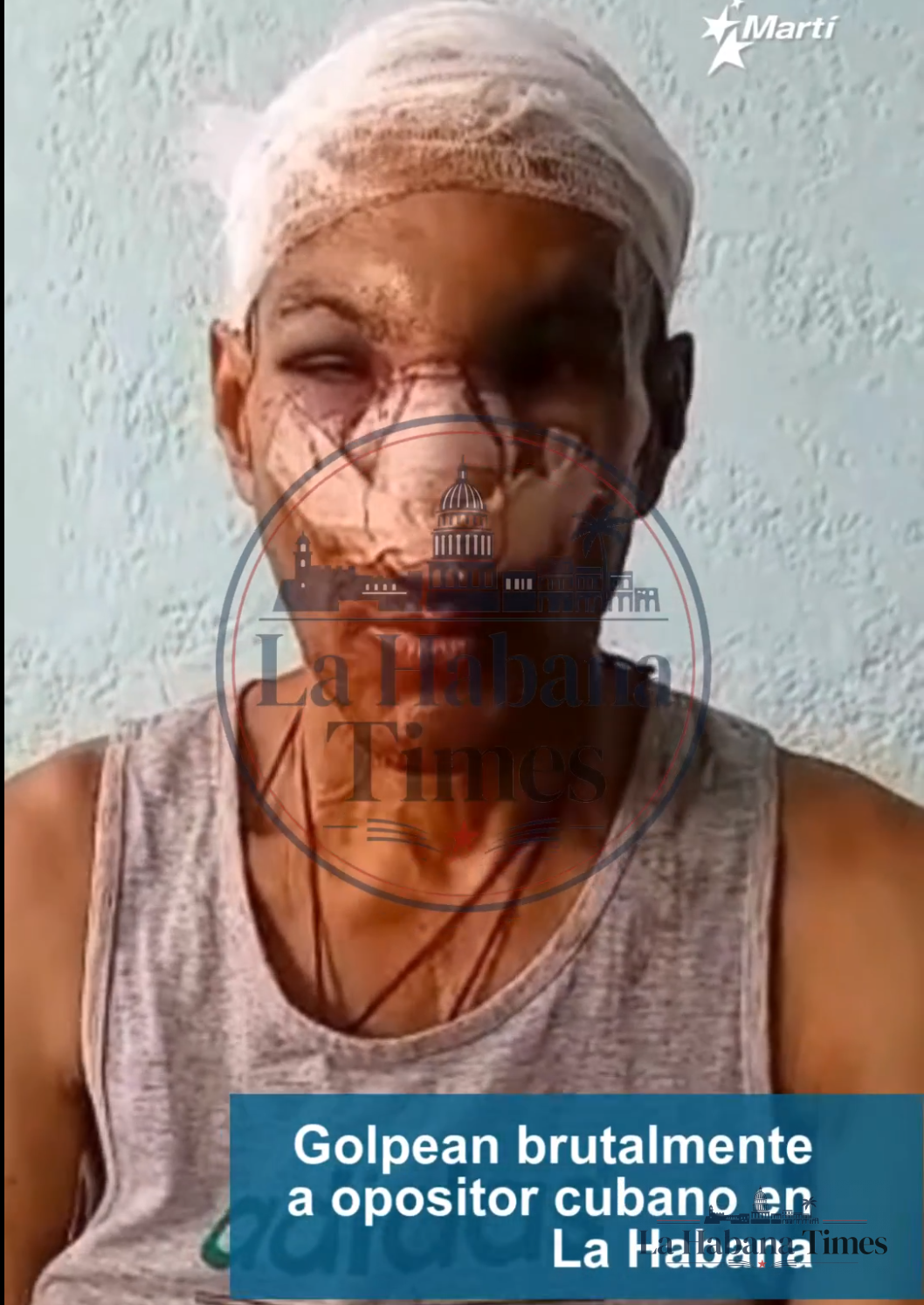 Opositor cubano Pablo Morales Marchán denuncia violenta golpiza en Centro Habana