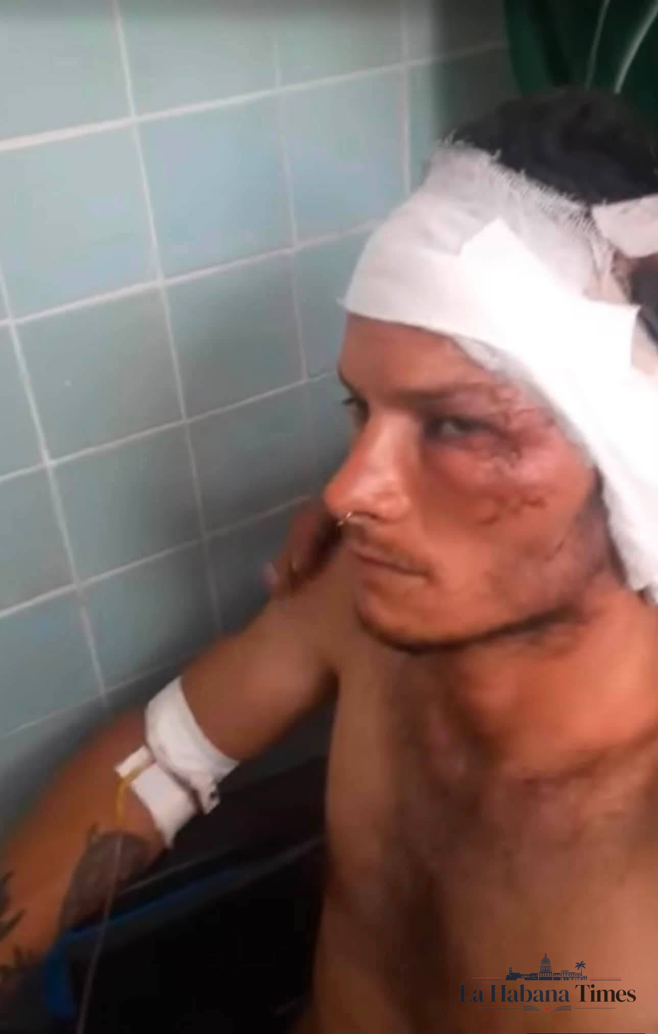 JOVEN PIERDE UNA OREJA TRAS BRUTAL ATAQUE A MACHETAZOS EN CIENFUEGOS; FAMILIA DENUNCIA POSIBLE MOTIVACIÓN POLÍTICA